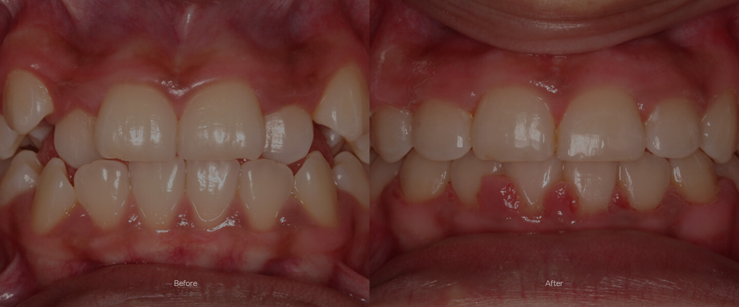 bkortho Orthodontist Brooklyn NY Brooklyn Orthodontics