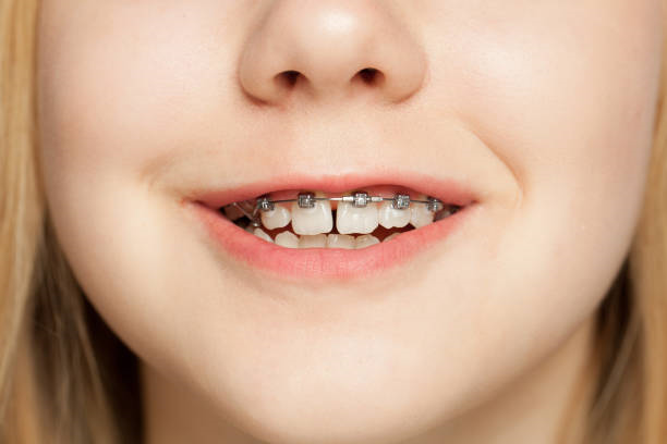 Dentofacial Orthopedics for Children