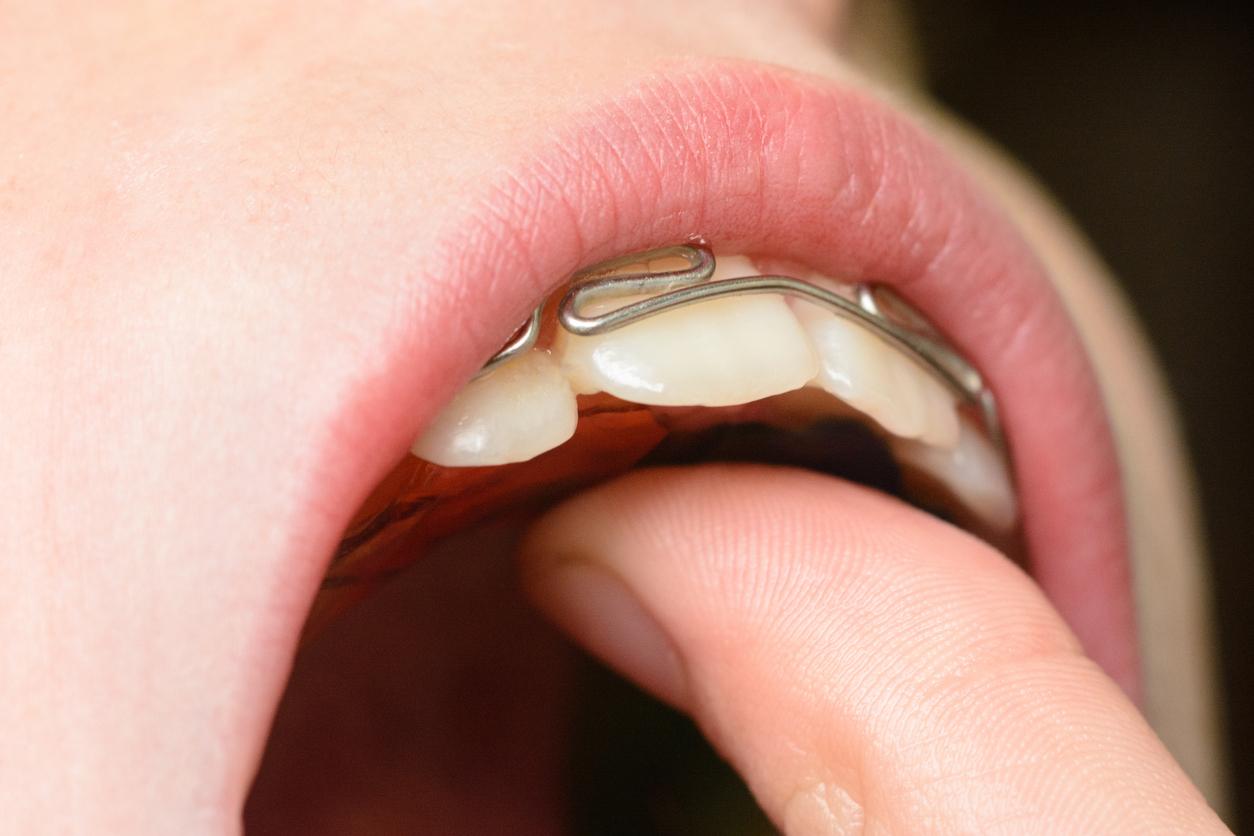 Retainers AFC, o pior dos 7 mil times ingleses